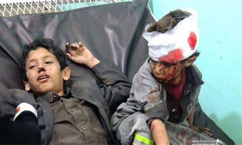 dos niños yemeníes heridos por bombas vendidas de EEUU a Arabia Saudí